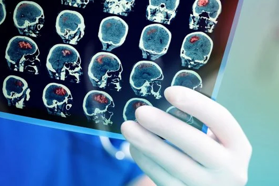 Abren inscripciones para charla sobre epilepsia infantil
