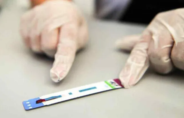 Los casos de sífilis crecieron 71% en 2025 y marcaron récord